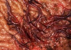 bloedworm